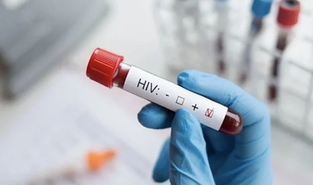 İzmir’de gerçekleşen skandal olay da  AIDS’e yakalanan 13 yaşındaki