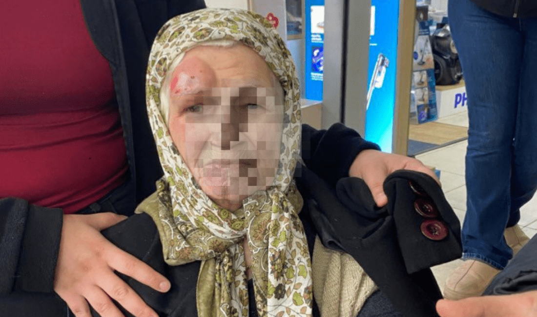 Sevgi Yolu üzerindeki kaldırım taşlarının hasar görmesi, yayalar için büyük