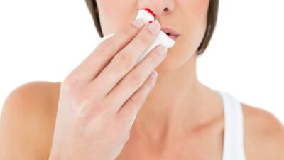 Burun kanaması, halk arasında sıkça karşılaşılan ve genellikle endişe yaratmayan