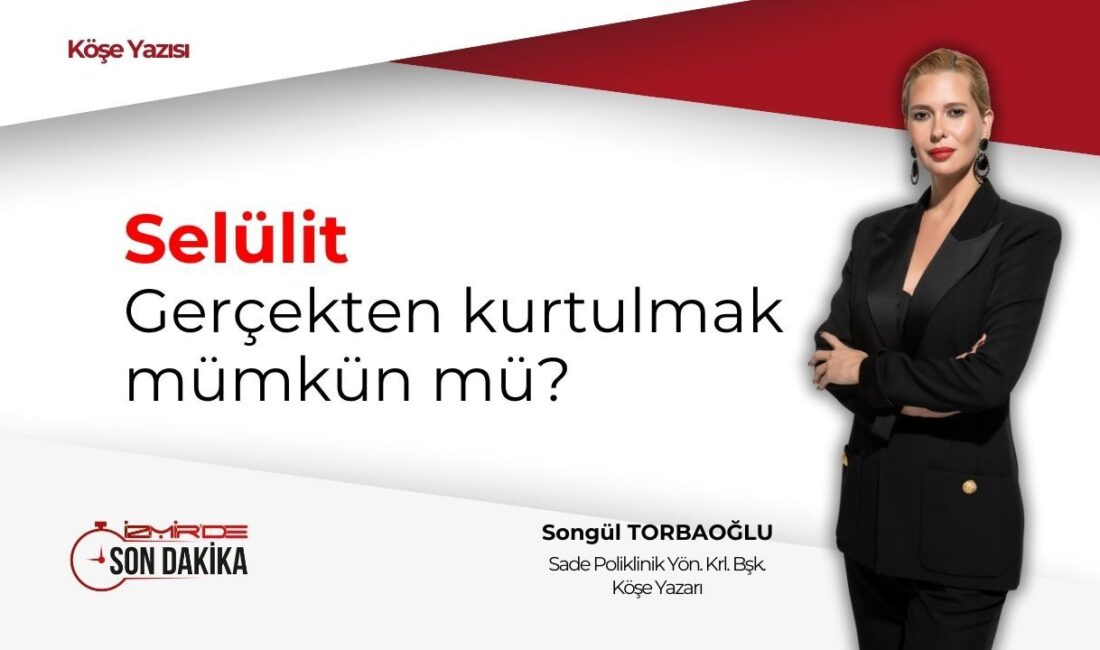 Selülit, kadınların büyük bir kısmını etkileyen ve estetik kaygılara yol