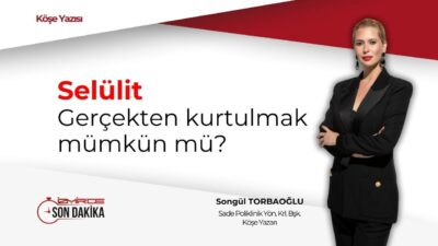 Selülit, kadınların büyük bir kısmını etkileyen ve estetik kaygılara yol