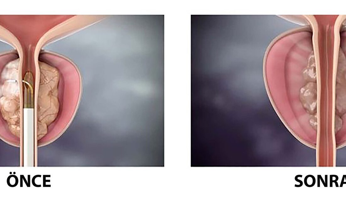 Bazekol Sağlık Grubu Çiğli Hastanesi Üroloji Uzmanı Prof. Dr. Orçun