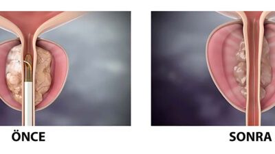Bazekol Sağlık Grubu Çiğli Hastanesi Üroloji Uzmanı Prof. Dr. Orçun