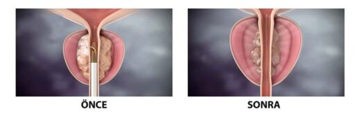 Bazekol Sağlık Grubu Çiğli Hastanesi Üroloji Uzmanı Prof. Dr. Orçun