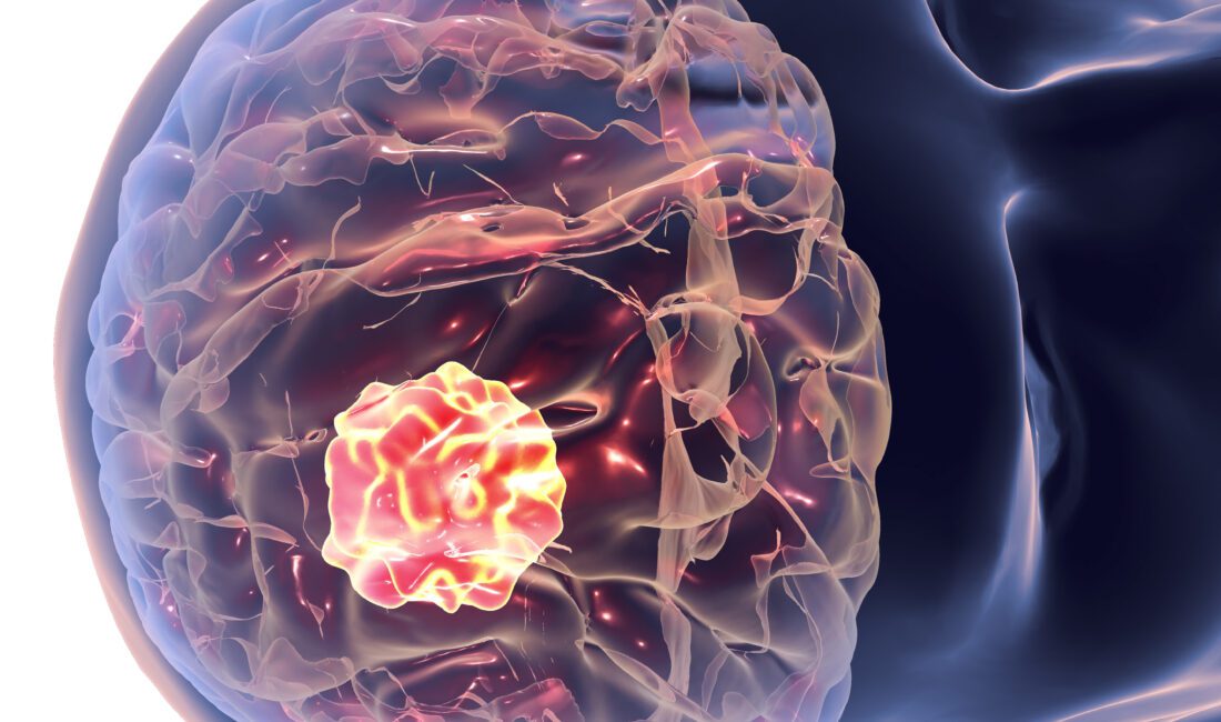 Bazekol Hastanesi Beyin ve Sinir Cerrahisi Uzmanı Opr. Dr. Haluk