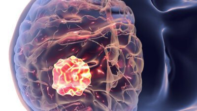 Bazekol Hastanesi Beyin ve Sinir Cerrahisi Uzmanı Opr. Dr. Haluk