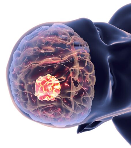 Bazekol Hastanesi Beyin ve Sinir Cerrahisi Uzmanı Opr. Dr. Haluk