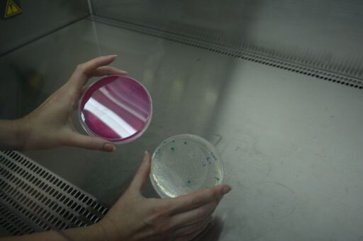 Ege Üniversitesi Mikrobiyolojik Analiz Laboratuvarı EGEMİKAL dezenfektanlarından su analizlerine kadar