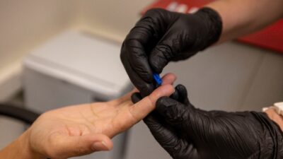 İzmir Büyükşehir Belediyesi, kimliksiz ve ücretsiz HIV, Hepatit ve sifiliz