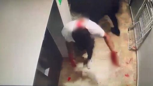 Kanı Donduran İddia Boşanma Aşamasındaki Koca, Eşini ve Yanındaki Erkeği Otelde Bıçakladı