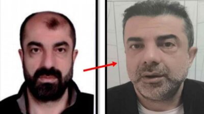 Estetik ameliyatla yüzünü değiştirip kardeşinin kimliğiyle ülkeye giren cinayet zanlısı